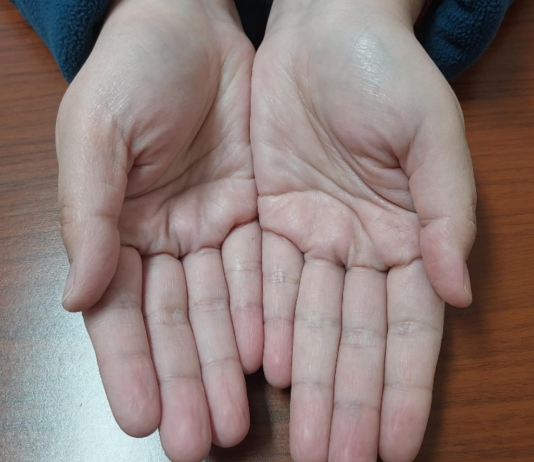 Catherine, 34 años, Tec. En enfermería